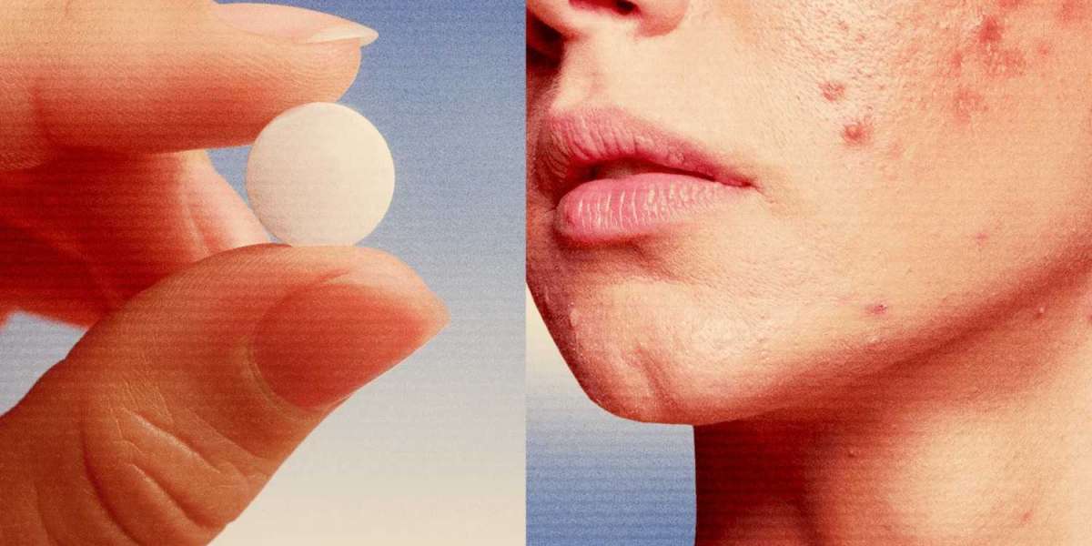 Acne Medication – Finding the Right Treatment for Clearer Skin