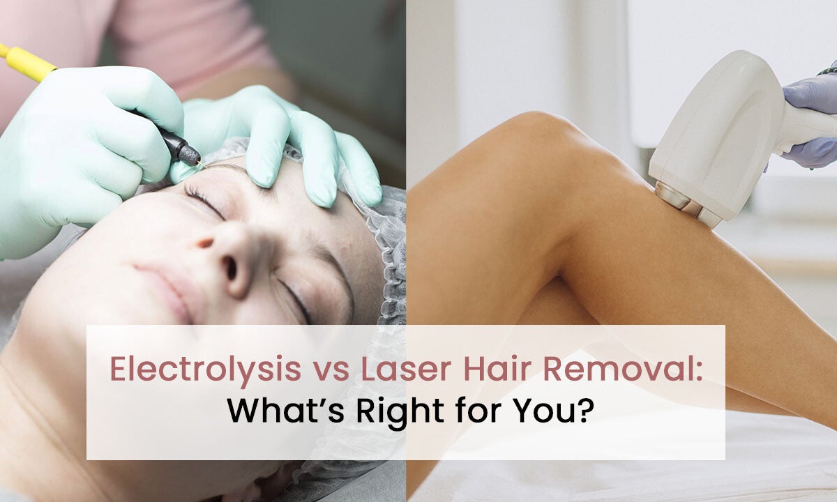 Electrolysis vs Laser Hair Removal: Which Is Right for You?