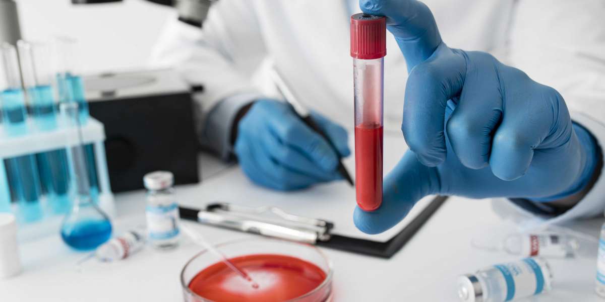 Why Do You Need a CBC Blood Test?