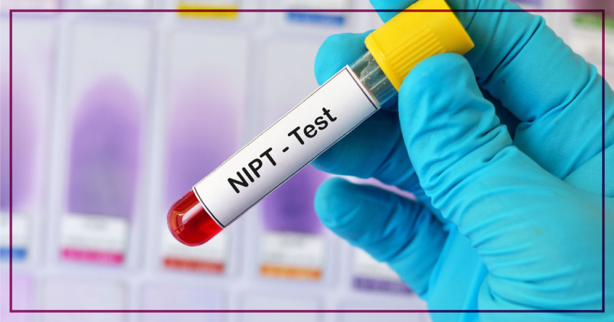 NIPT Test in Chandigarh | All Chromosome Test in Chandigarh