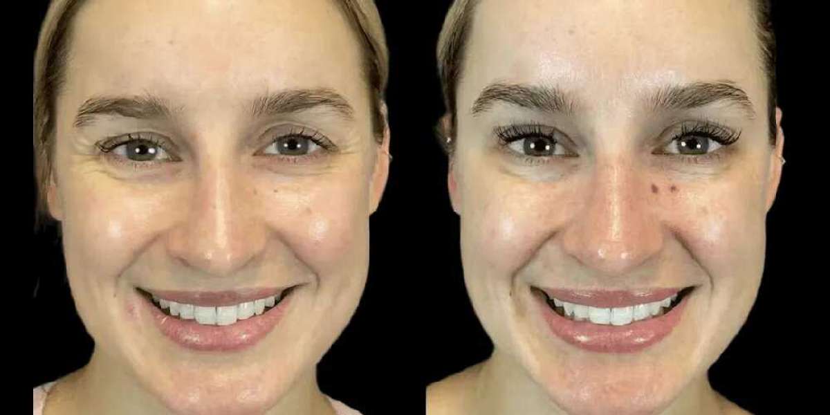Combining Wellness and Beauty at the Best Aesthetic Clinic in Dubai