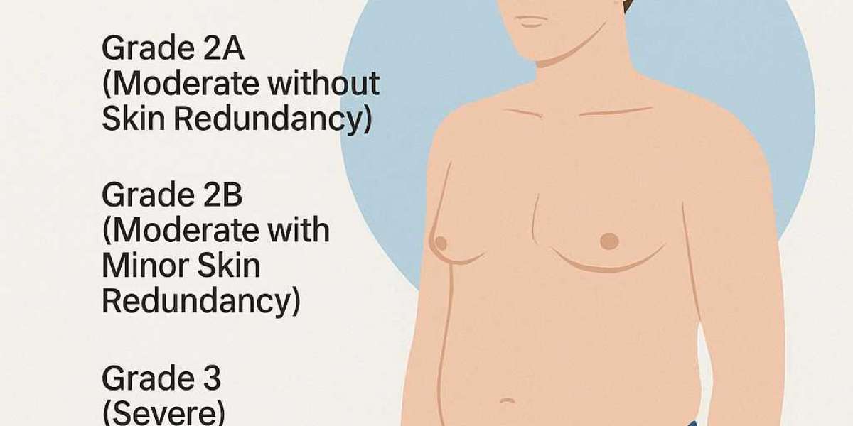 Painless gynecomastia treatment options in Pune