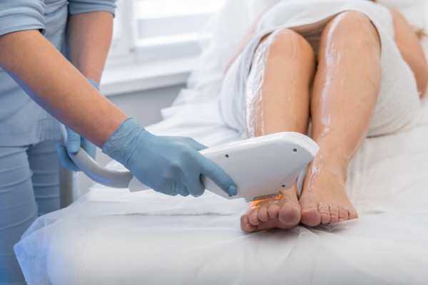 Laser Hair Removal in Leicester
