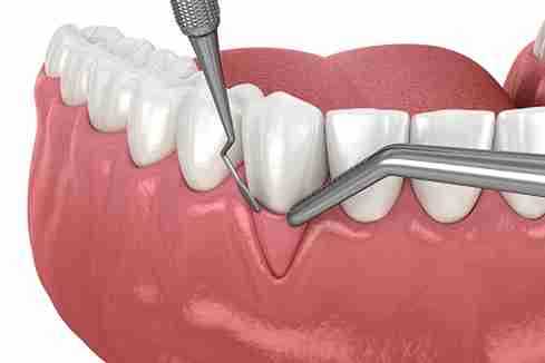 Image Source - Emergency Dentist Crawley