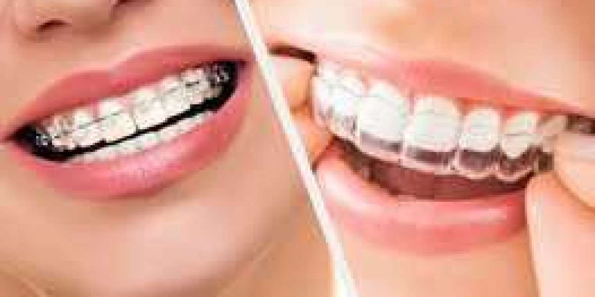 Orthodontic Treatment in Hoodi: Everything You Need to Know