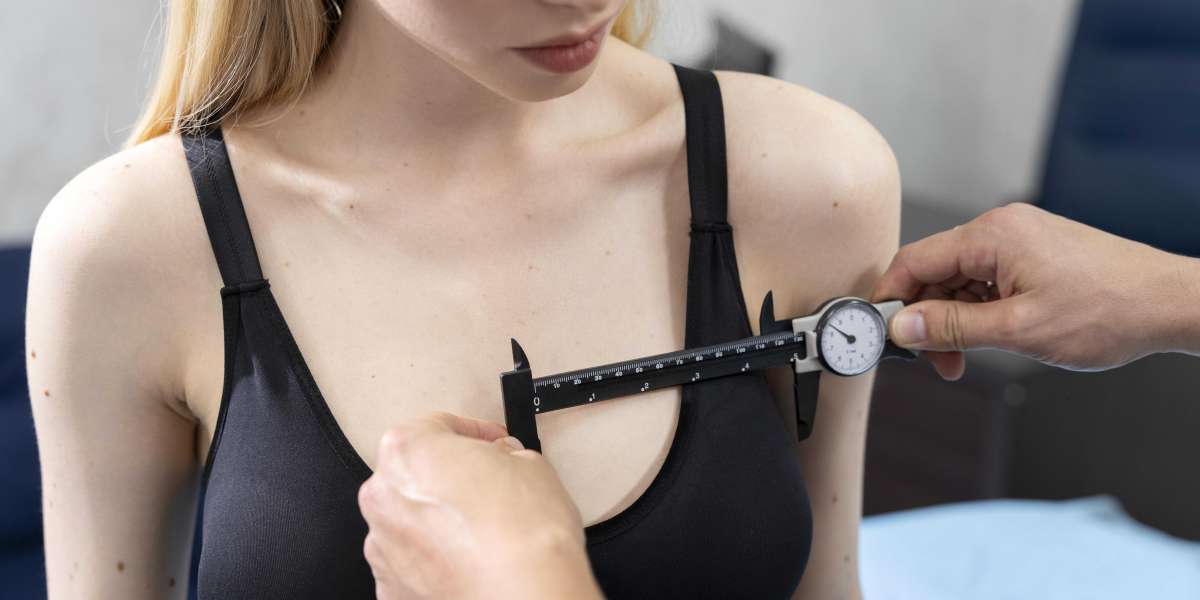 Breast Lift or Reduction? Which Procedure Matches Your Lifestyle and Body Goals