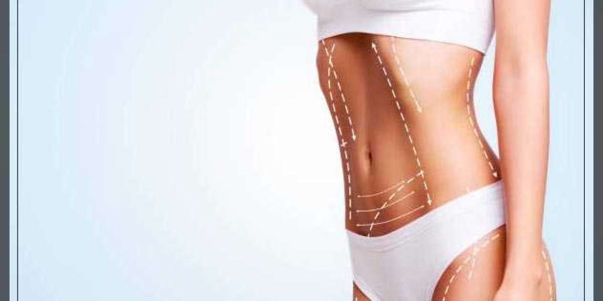 Why Abdominoplasty in Dubai is Popular for Body Contouring