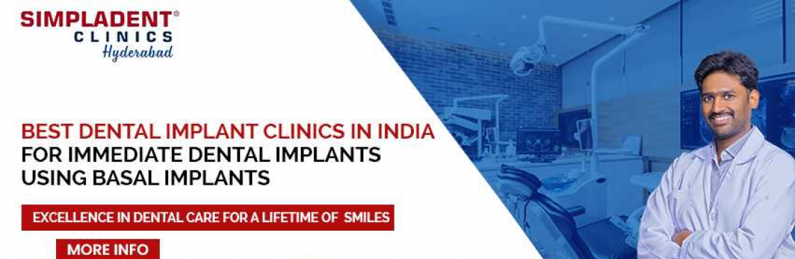 Best Doctors For Dental Implantation in Hyderabad Cover Image