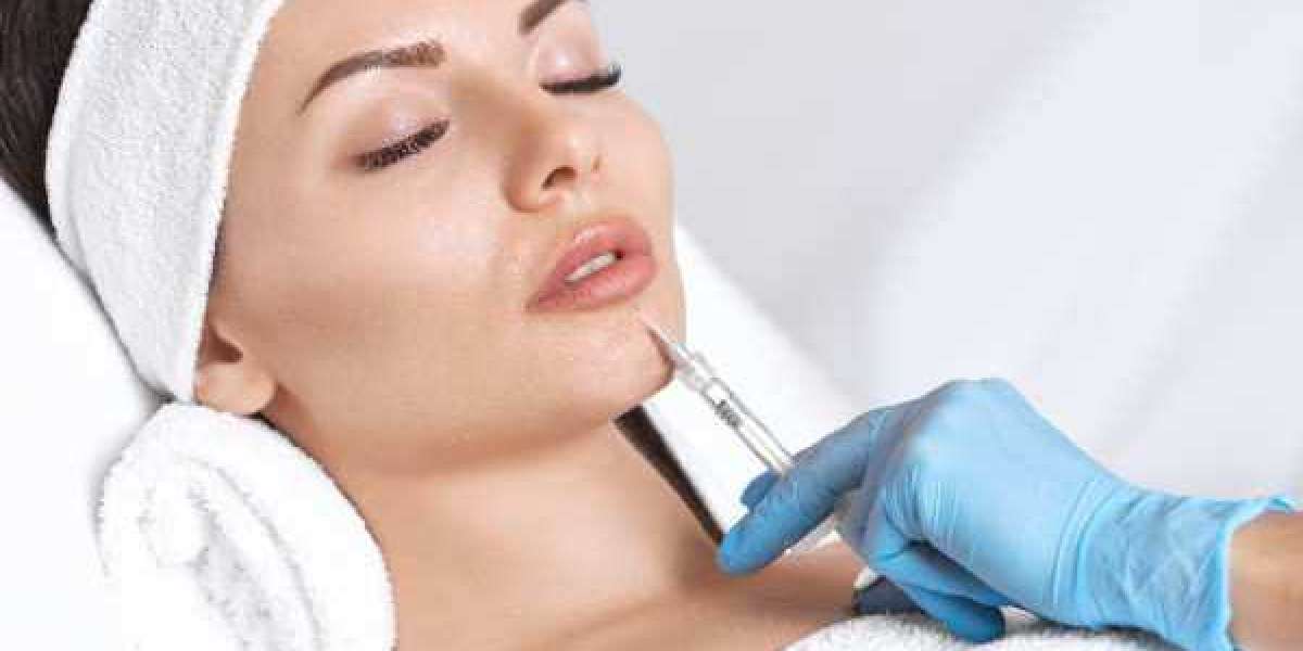 The Smile Makeover Secret: Lip Fillers and Dental Expertise