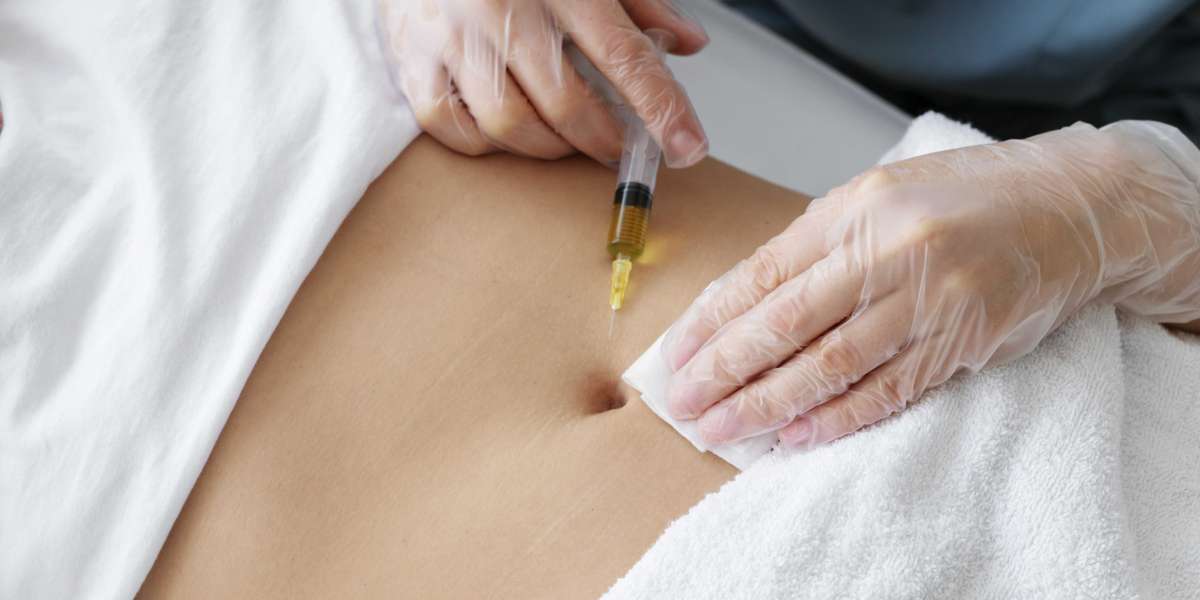 Chemical Peels for Stretch Marks: Best Acids, Depths & Post-Care