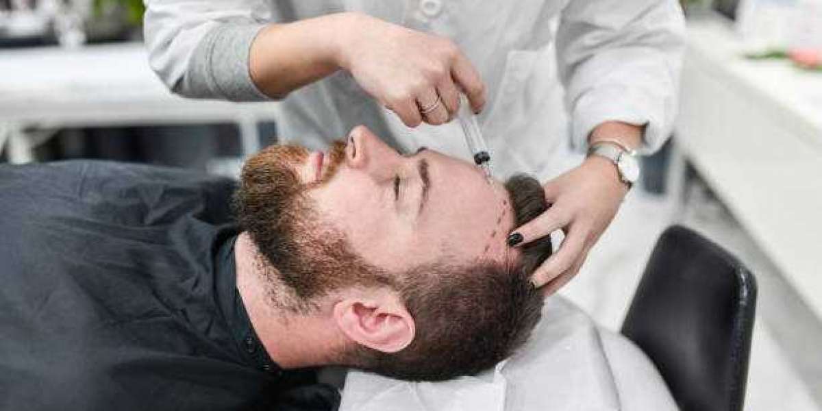 Regain Confidence with Advanced Hair Transplant Solutions in Islamabad