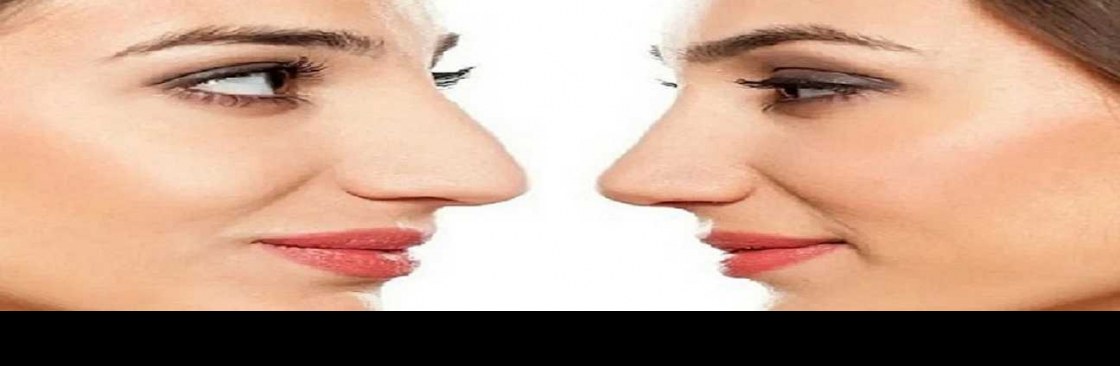 La rinoplastica in Ospedale Cover Image