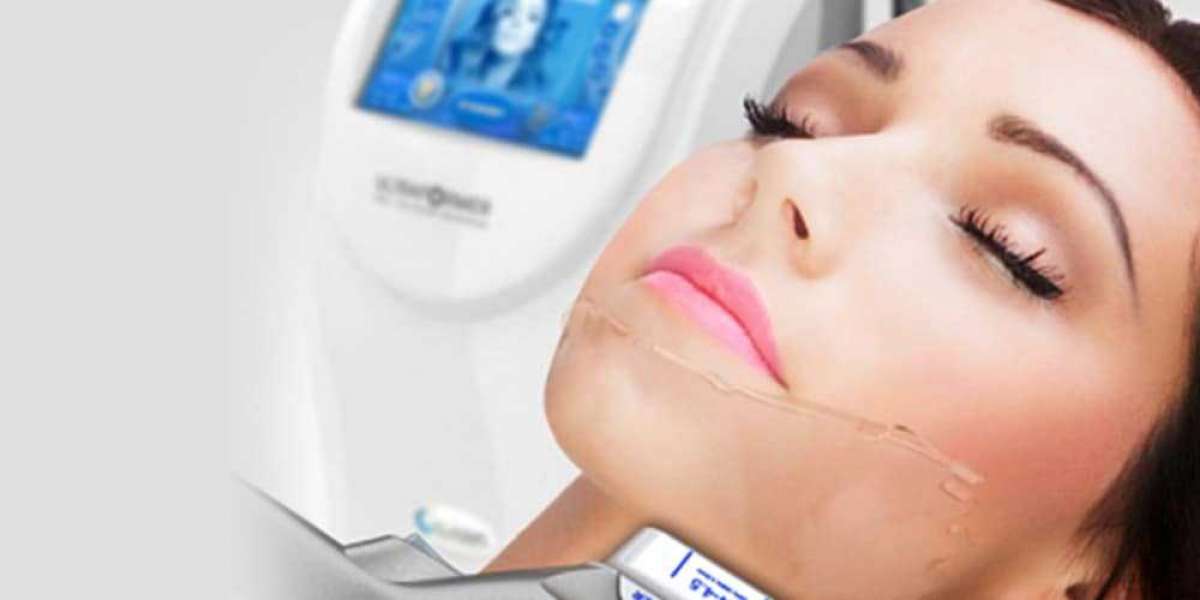 HIFU in London – Non-Surgical Ultrasound Skin Tightening for Natural Lifting and Long-Term Results
