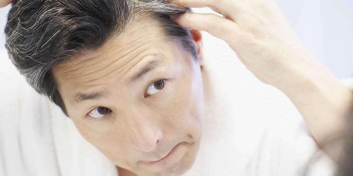 Hair Transplant Cost in Dubai and Restoration Plans