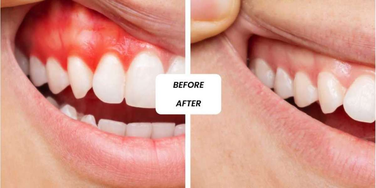 General Dentistry in Dubai: Complete Oral Health Care for Daily Needs