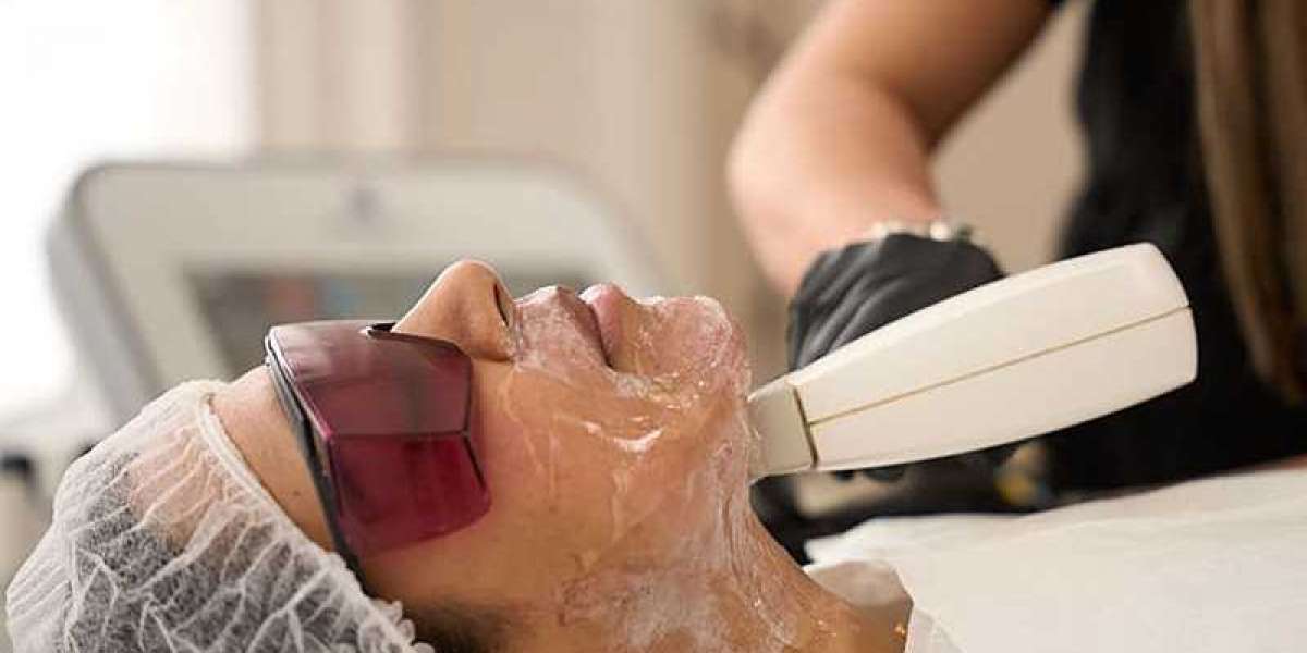 Fractional Laser Treatment In London: Advanced Skin Resurfacing