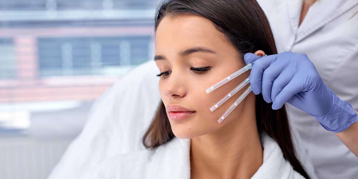 Is a Thread Lift Permanent?