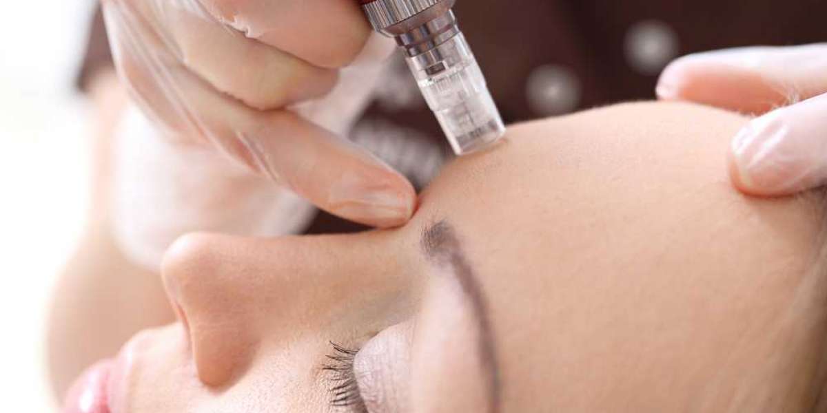 How Experience Influences Mesotherapy Cost in Dubai