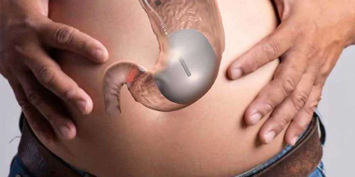 Does Allurion Gastric Balloon Clinic enhance metabolic progress?