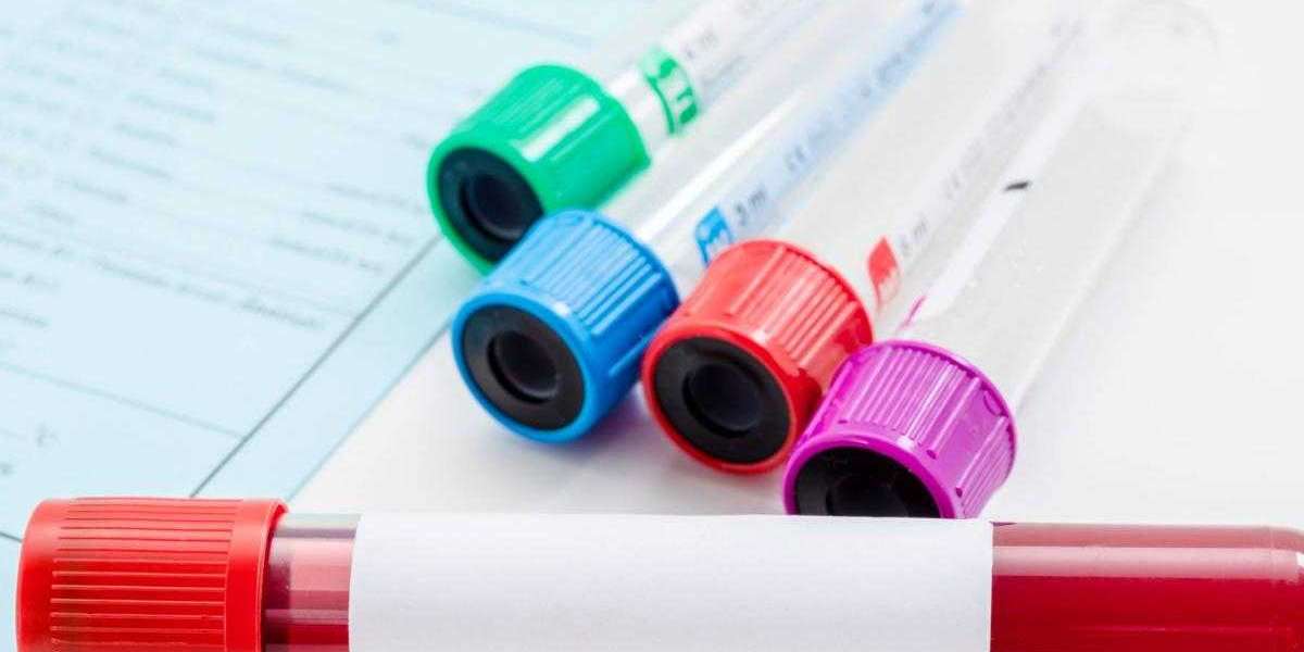 Hepatitis B Test in Dubai for Peace of Mind